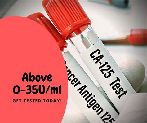 ca125 blood test bottle|how is ca125 measured.